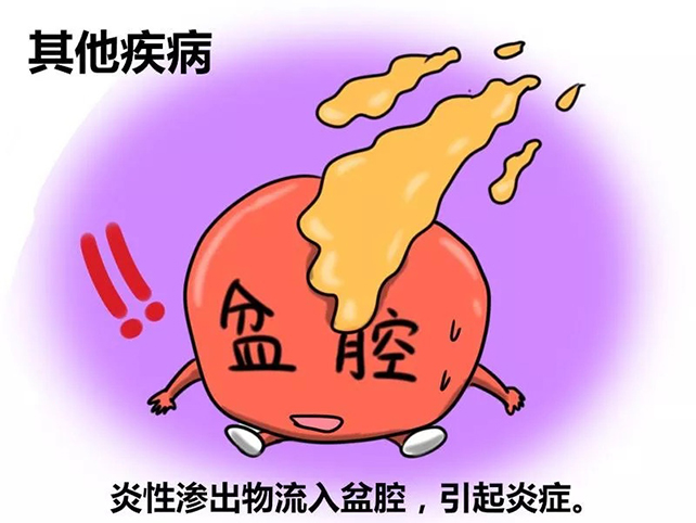 一次成功的最低费用!北医三院第二代供卵试管婴儿费用明细表