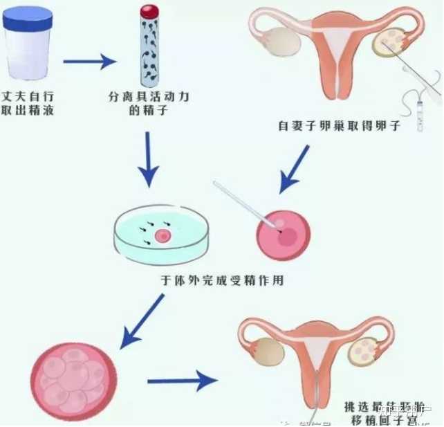 下调在供卵试管代怀医院治疗中是什么意思？