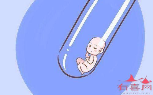 哪些情况适合做第三代赠卵借卵试管供卵？