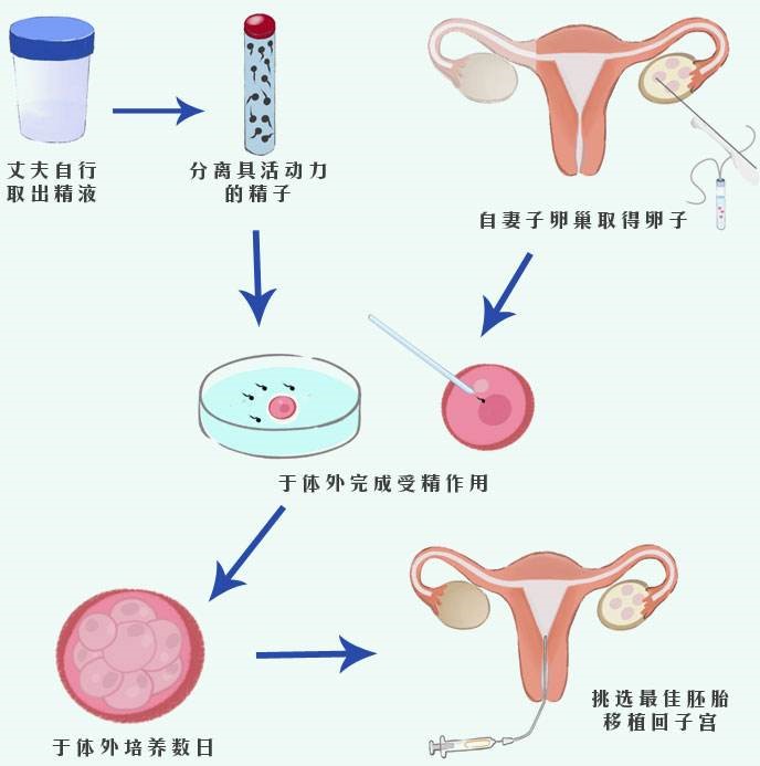 借卵试管三代代怀成功率和什么相关取出卵子越多越好