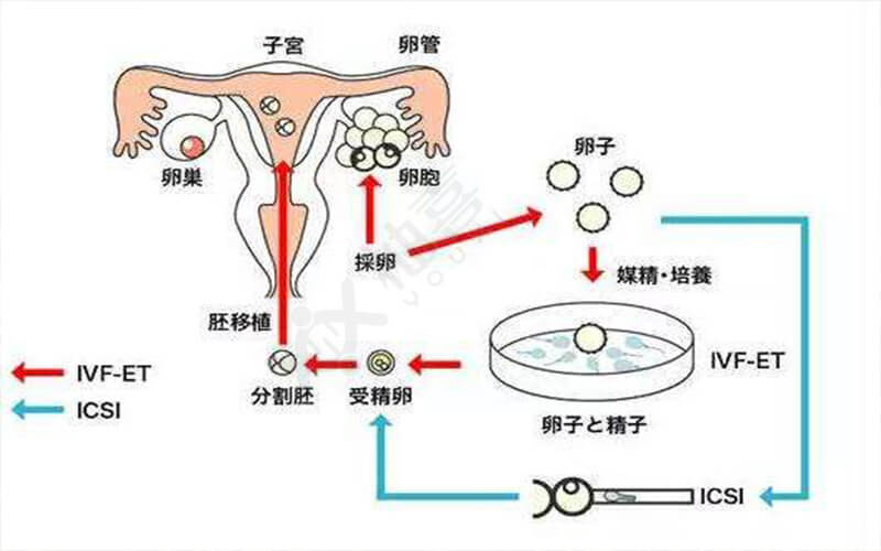 试管婴儿能繁殖后代吗