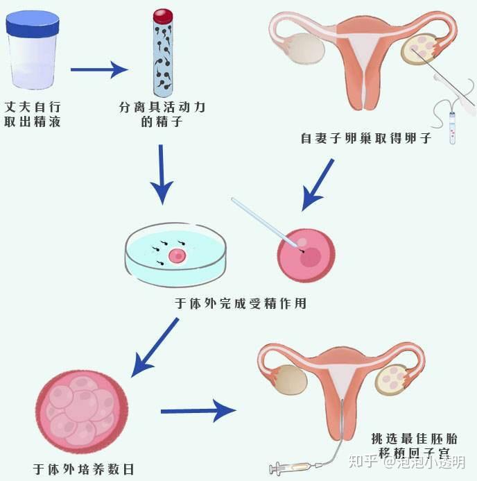 赴广州试管代怀包生男孩有吗生活篇住宿酒店这3点很重要
