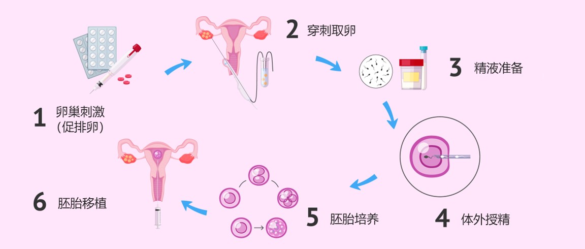 金边第一试管代怀包成功哪家好中心的具体位置在哪里？
