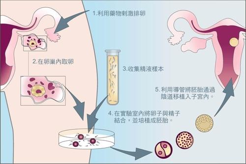 广州求助试管代怀国外做试管代怀怎么样包儿子