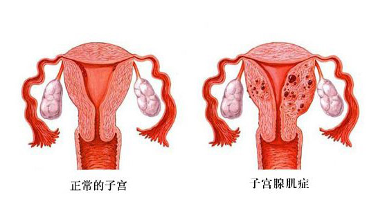 试管代怀哪家优惠+胚胎这样移植受孕机会大+